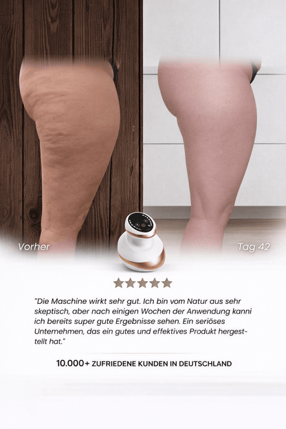 Sculptify™ Cellulite Massager