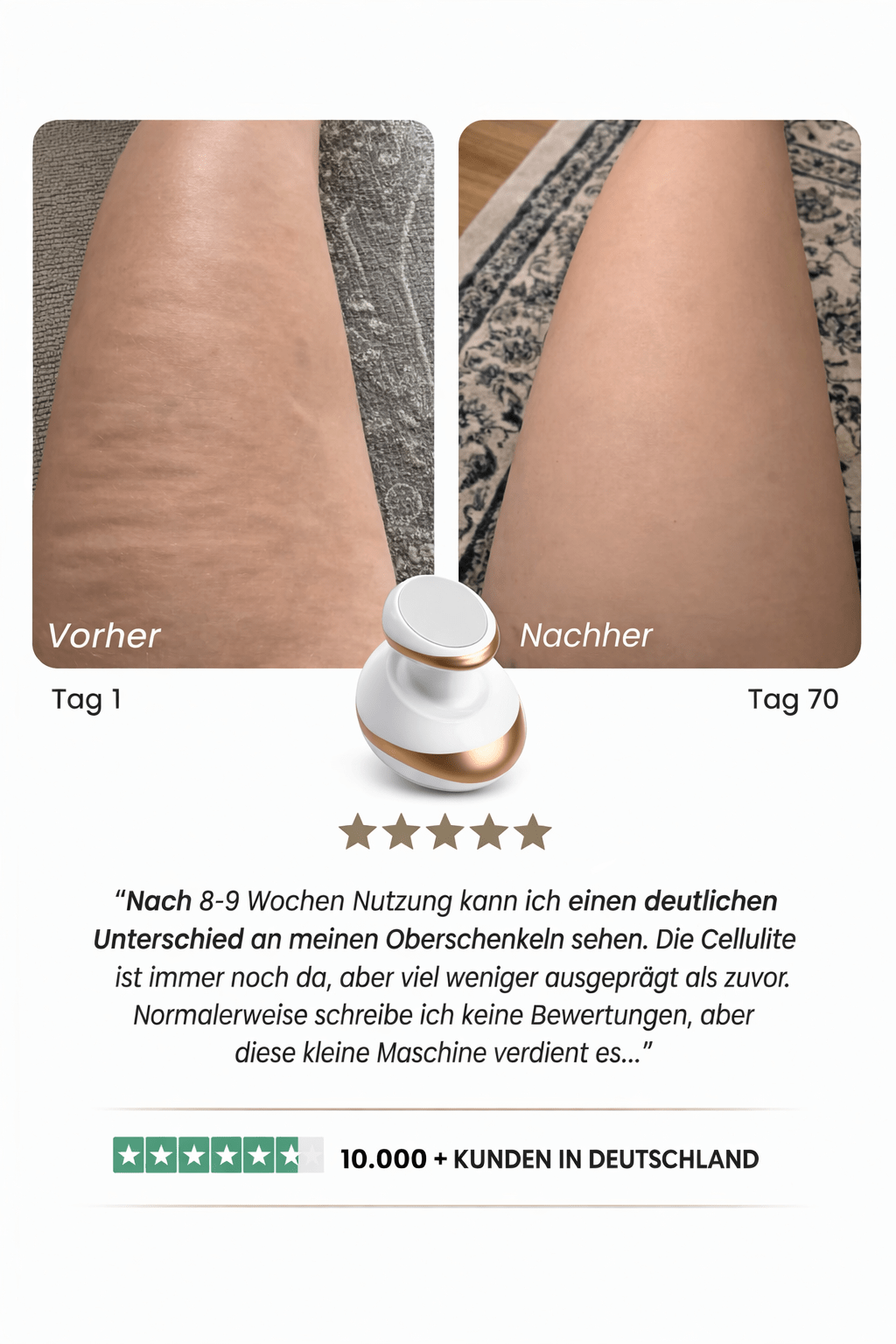 Sculptify™ Cellulite Massager