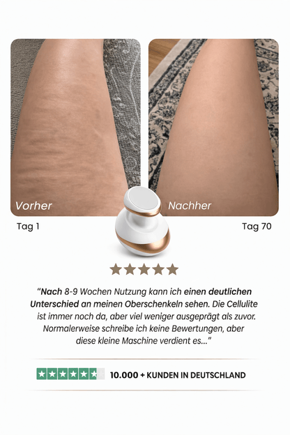 Sculptify™ Cellulite Massager